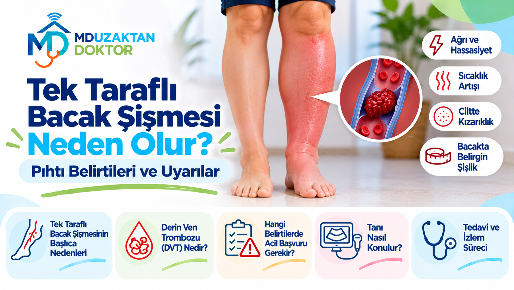 Tek Taraflı Bacak Şişmesi Neden Olur? Pıhtı Belirtileri ve Uyarılar
