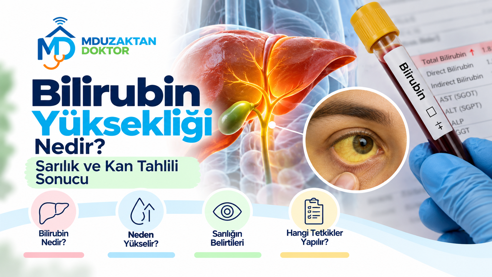 Bilirubin Yüksekliği Nedir? Sarılık ve Kan Tahlili Sonucu